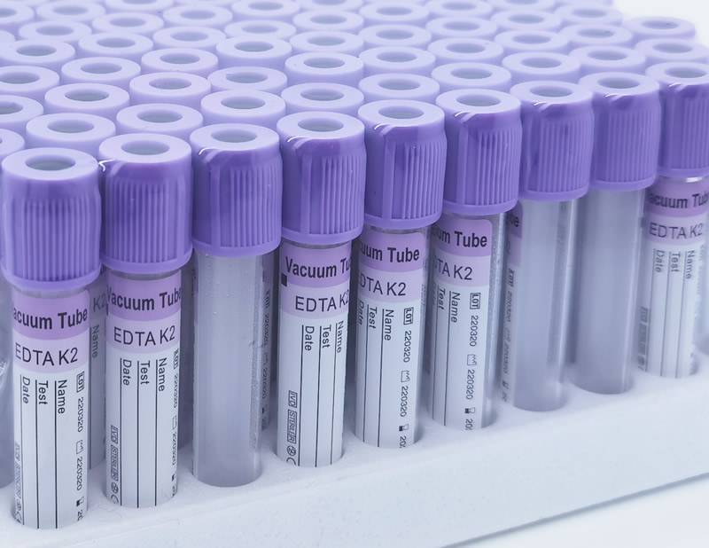 Epruveta za odvzem krvi EDTA K2